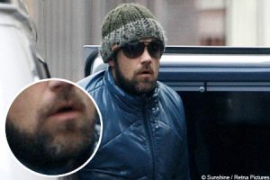 Robbie in his Bill Oddie disguise